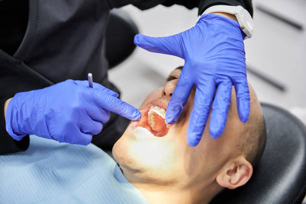 Best Emergency Wisdom Tooth Extraction in Bonnie Brae, IL